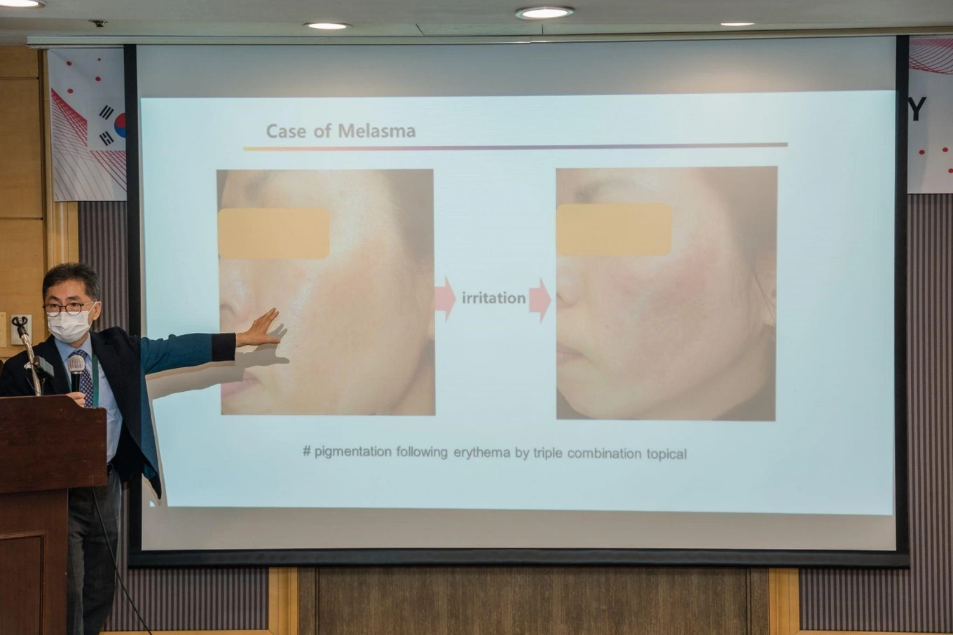 Giải pháp cho da sạm nám ở hội thảo quốc tế tại Hàn Quốc