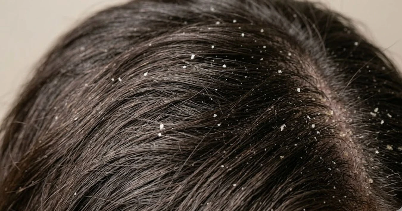 Sản Phẩm Chăm Sóc Da Đầu Everygreen